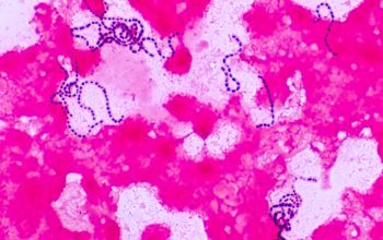 Streptococcus parasanguinis Gram stain