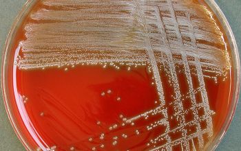 Streptococcus parasanguinis Blood Agar 48h culture incubated with CO2
