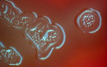 Streptococcus pneumoniae Blood Agar 48h culture incubated with CO2