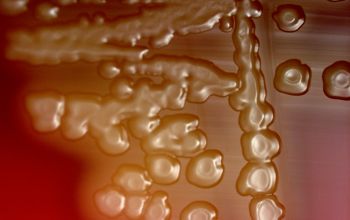 Streptococcus pneumoniae Blood Agar 48h culture incubated with CO2