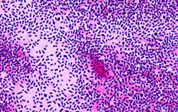 Streptococcus pneumoniae Gram stain