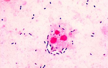 Streptococcus pneumoniae Gram stain