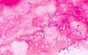 Streptococcus pneumoniae Gram stain