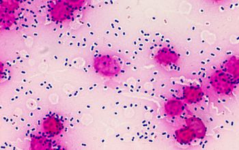 Streptococcus pneumoniae Gram stain