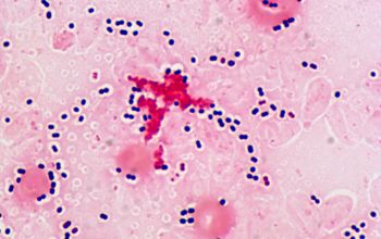 Streptococcus pneumoniae Gram stain