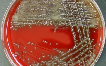 Streptococcus pneumoniae Blood Agar 24h culture incubated with CO2