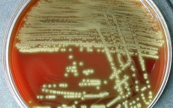 Streptococcus pneumoniae Blood Agar 48h culture incubated with CO2