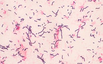 Streptococcus pyogenes Gram stain