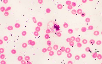 Streptococcus pyogenes Gram stain