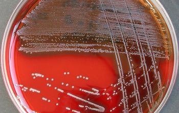 Streptococcus pyogenes Blood Agar 24h culture incubated with CO2