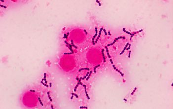 Streptococcus pyogenes Gram stain