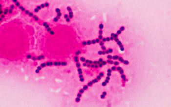 Streptococcus pyogenes Gram stain