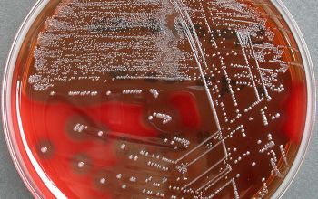 Streptococcus pyogenes Blood Agar 24h culture incubated with CO2