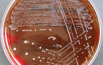 Streptococcus pyogenes Blood Agar 48h culture incubated with CO2