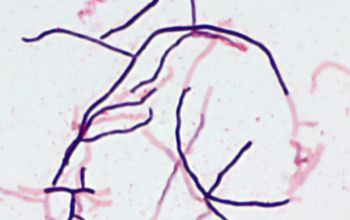 Streptomyces griseus Gram stain