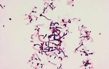 Streptomyces griseus Gram stain
