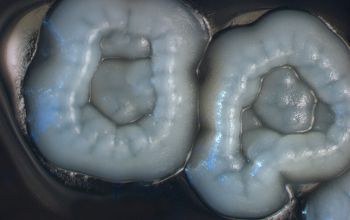 Streptomyces griseus  culture incubated with O2