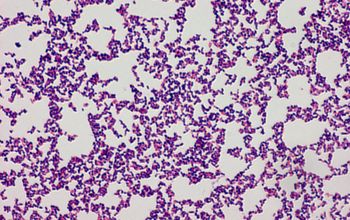 Treuperella pyogenes (Arcanobacterium pyogenes) Gram stain