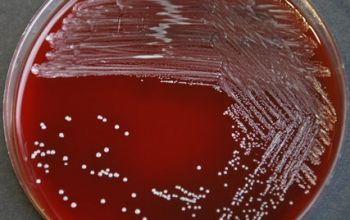 Treuperella pyogenes (Arcanobacterium pyogenes) Blood Agar 48h culture incubated with CO2