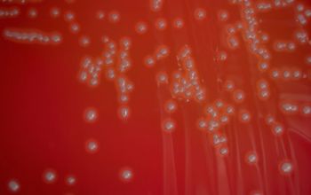 Treuperella pyogenes (Arcanobacterium pyogenes) Blood Agar 48h culture incubated with CO2