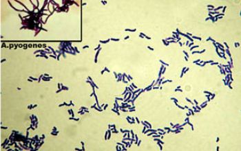 Treuperella pyogenes (Arcanobacterium pyogenes) Gram stain