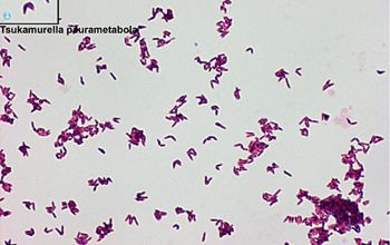 Tsukamurella species Gram stain