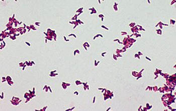 Tsukamurella species Gram stain