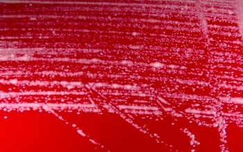 Tsukamurella species Blood Agar 48h culture incubated with O2