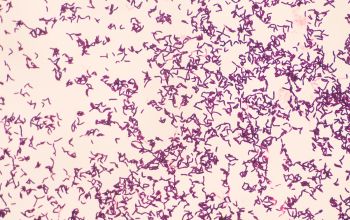 Turicella otitidis Gram stain