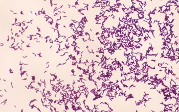 Turicella otitidis Gram stain