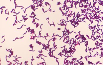 Turicella otitidis Gram stain