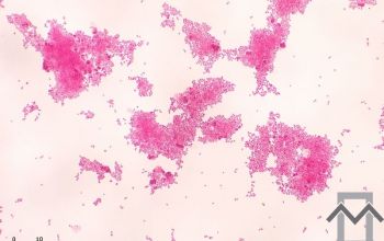 Veillonella parvula Gram stain