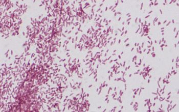 Vibrio alginolyticus Gram stain