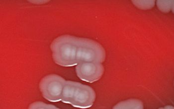 Vibrio alginolyticus Blood Agar 24h culture incubated with CO2