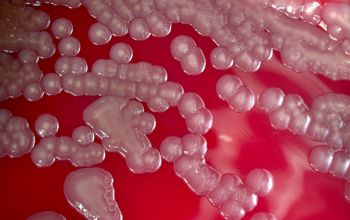 Vibrio cholerae Blood Agar 24h culture incubated with CO2
