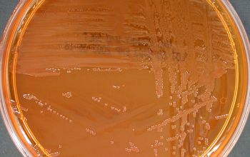 Vibrio cholerae Mac Conkey Agar without salt 24h culture incubated with CO2