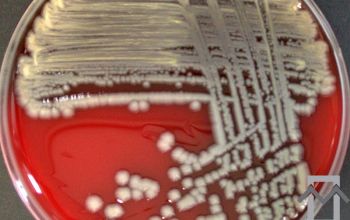 Vibrio parahaemolyticus Blood Agar 24h culture incubated with CO2