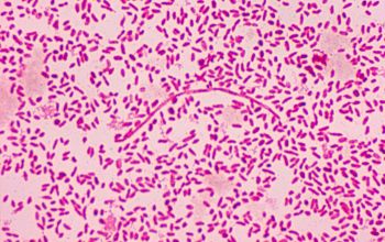 Vibrio vulnificus Gram stain