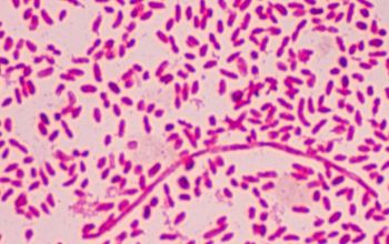 Vibrio vulnificus Gram stain