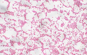 Wautersiella falsenii / Empedobacter falsenii Gram stain