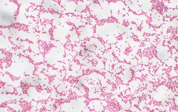 Wautersiella falsenii  (Empedobacter falsenii) Gram stain