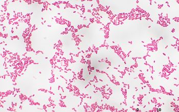 Wautersiella falsenii / Empedobacter falsenii Gram stain