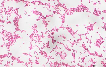 Wautersiella falsenii  (Empedobacter falsenii) Gram stain