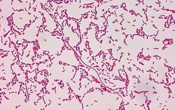 Weeksella virosa Gram stain