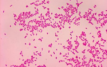 Yersinia enterocolitica Gram stain