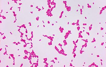 Yersinia enterocolitica Gram stain