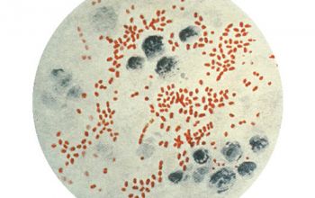 Yersinia pestis 