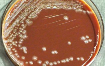 Yersinia pestis  culture 