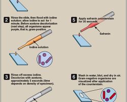 Gram staining