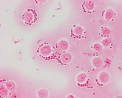 Gram staining